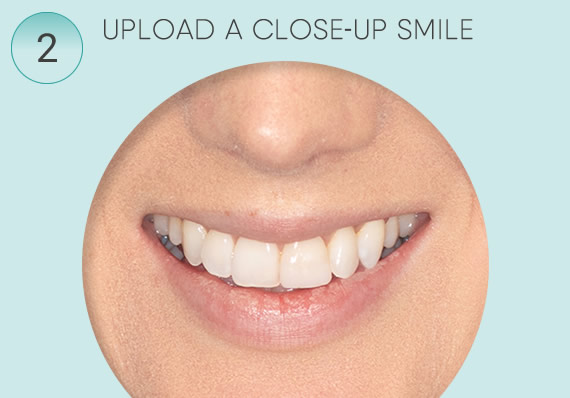 Closeup of Smile